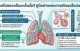 “เจอจุดที่ปอด” ต้องกังวลแค่ไหน?