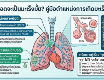 “เจอจุดที่ปอด” ต้องกังวลแค่ไหน?