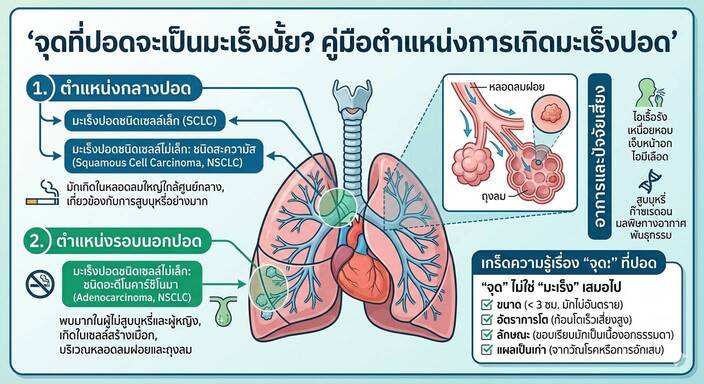 “เจอจุดที่ปอด” ต้องกังวลแค่ไหน?